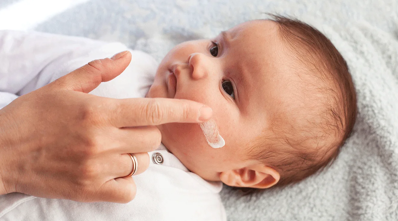 mother putting cream on baby's face to calm eczema