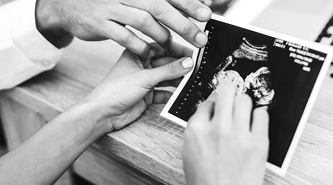 black and white image of woman and doctor's hands looking at sonogram