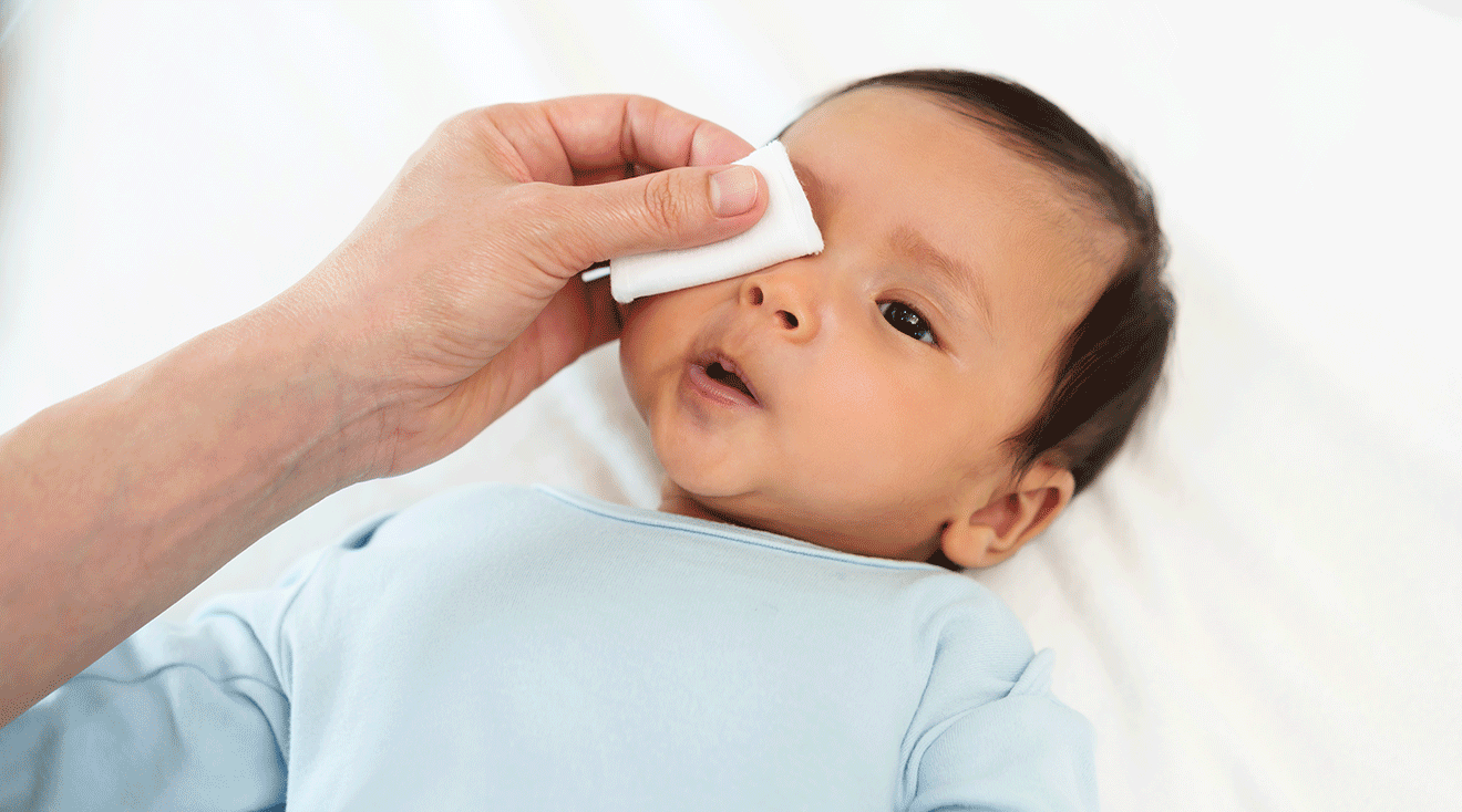 mother wiping baby's eye with warm compress for blocked tear duct