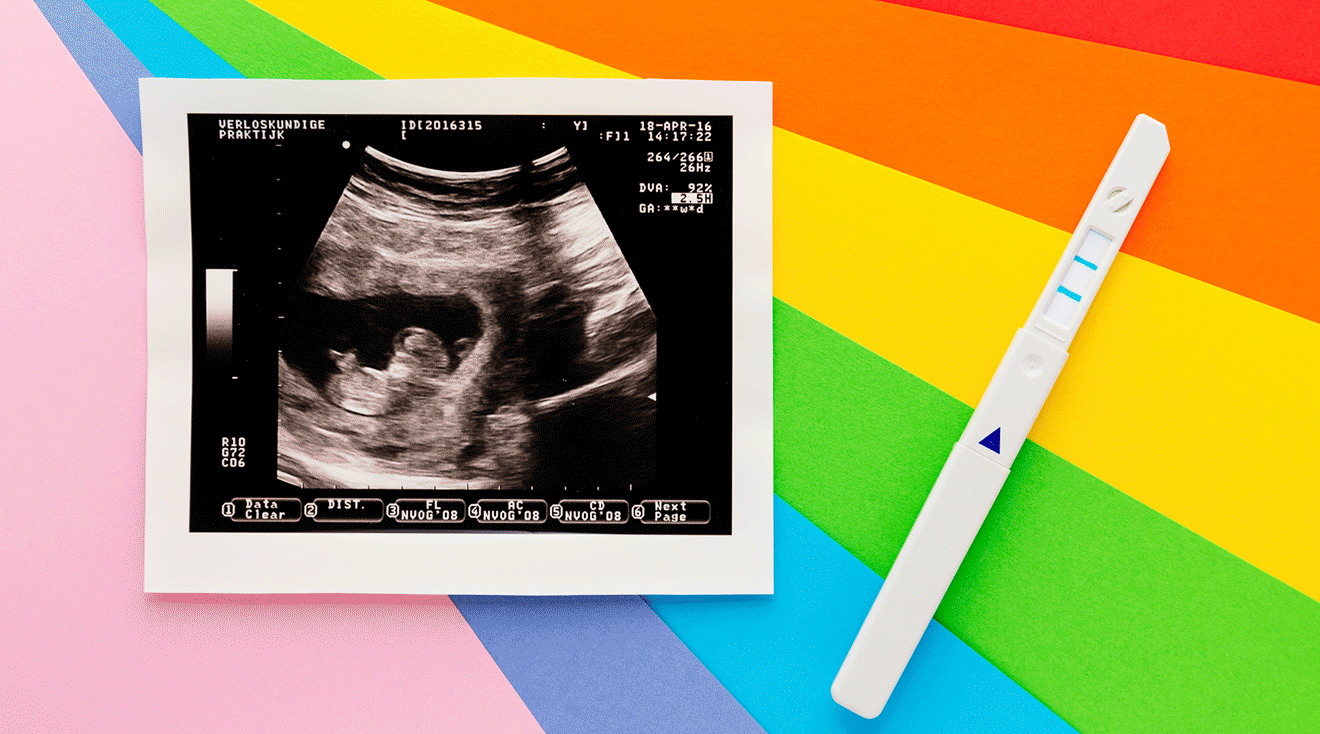 ultrasound photo and positive pregnancy test on rainbow background-rainbow baby concept