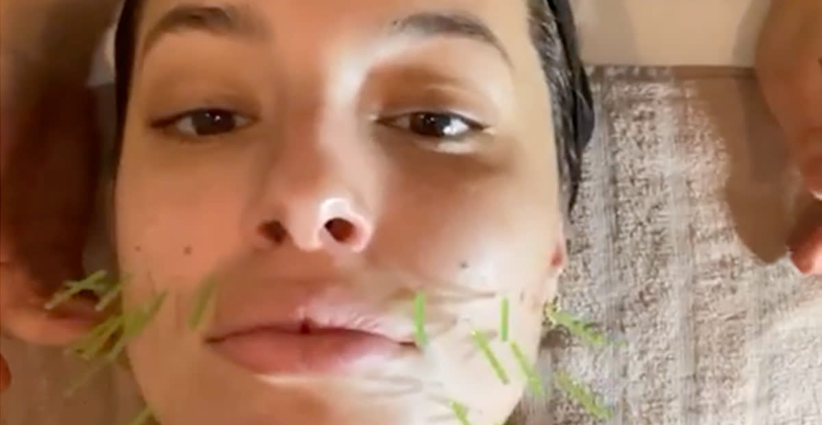 Ashley Graham Reveals Acupuncture Has Helped Her Through Pregnancy Ashley Graham Reveals Acupuncture Has Helped Her Through Pregnancy