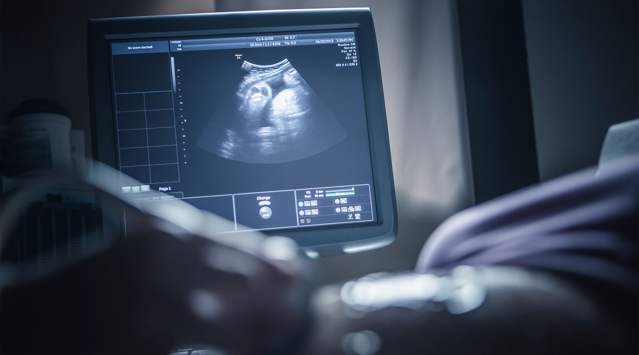 sonogram machine at doctor's office