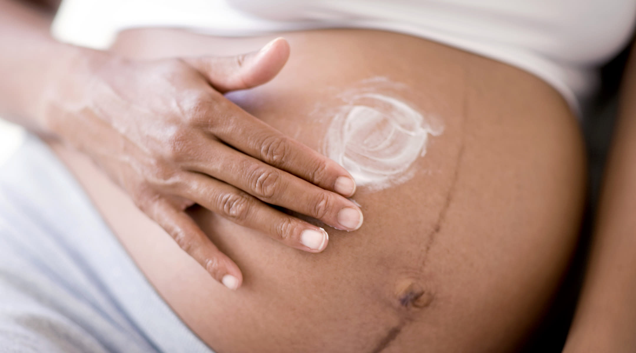 How To Avoid Stretch Markss During Pregnancy Home Remedies