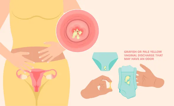 Vaginal Discharge Consistency, Cervical Mucus & Cervical Fluid: What Does it Mean