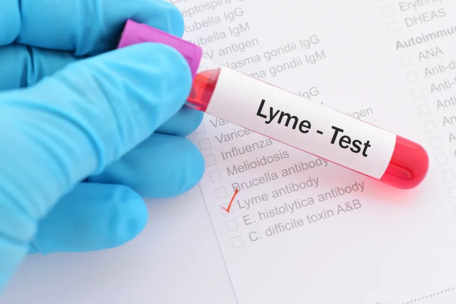 Person wearing medical exam glove holding a vile that's labeled Lyme test