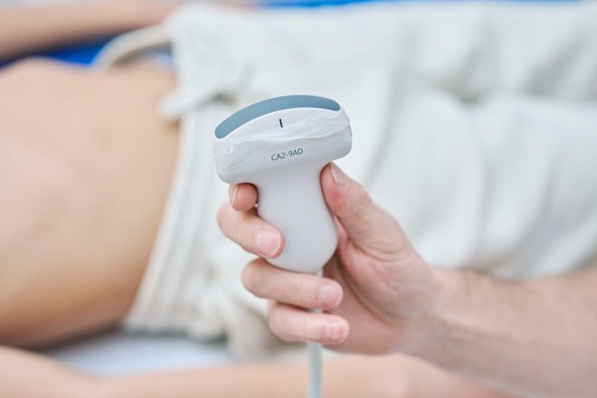 Beitragsbild: Gefäßverkalkung: Die schleichende Gefahr – und wie Sie Ihre Adern jung halten