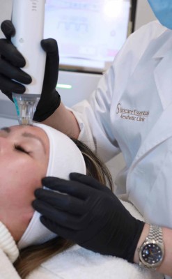 Potenza RF Microneedling