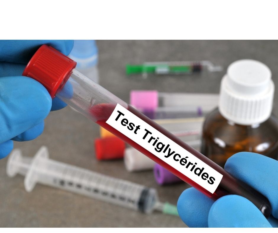 blood test triglycerides