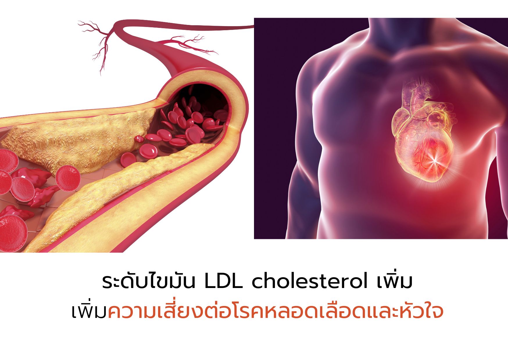 cardiovascular cvd