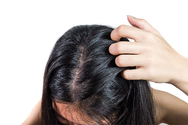 donna controlla forfora tra i capelli lunghi