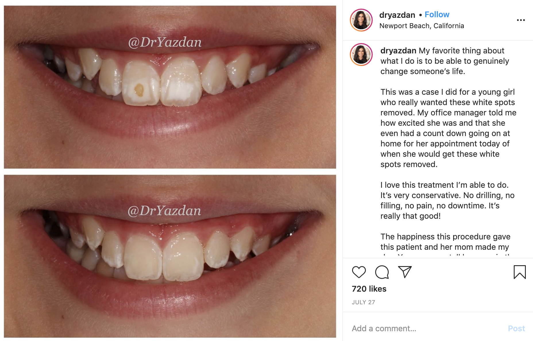 Example of dentist work via Instagram Post 