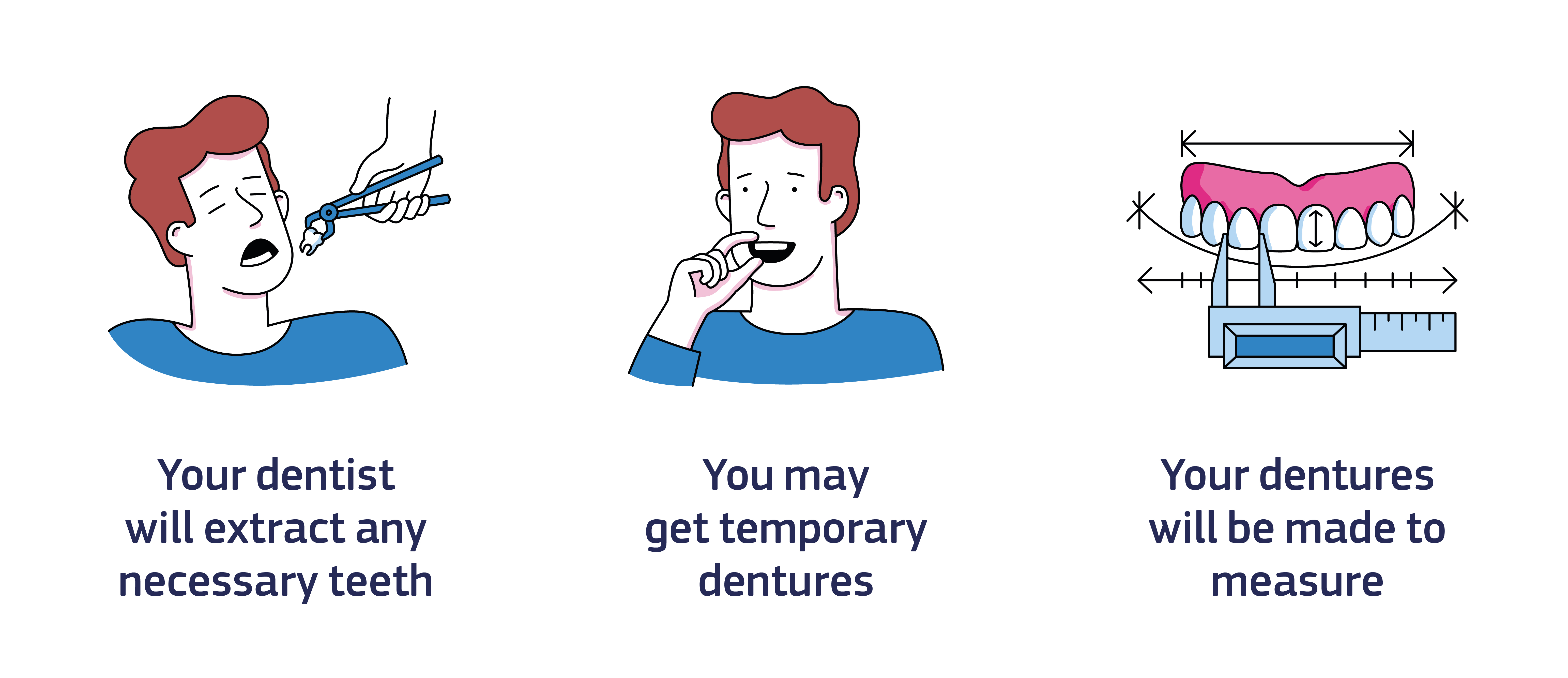 An infographic showing what to expect at the dentist: Step 1. Your dentist will extract any necessary teeth. Step 2. You may get temporary dentures. Step 3. Your dentures will be made to measure.