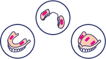 Apply adhesive in thin continuous strips as shown. You might need a few tries to find out the ideal amount for your individual denture. The maximum size of each strip should be no more than 4x17 mm.