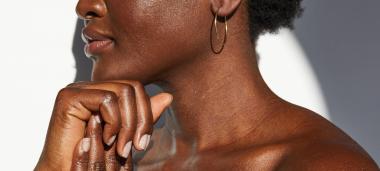 Do you have Eczema? Natural Remedies For Dark Skin Decoloration