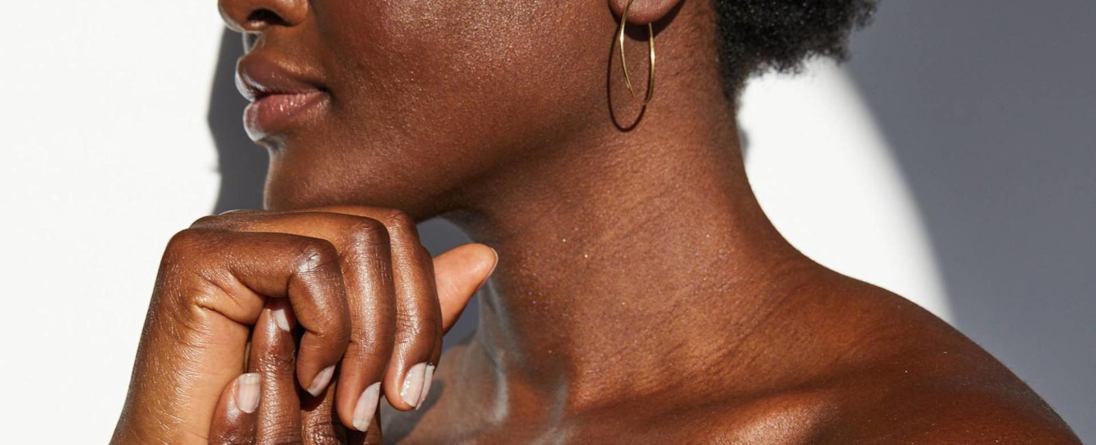 Do you have Eczema? Natural Remedies For Dark Skin Decoloration