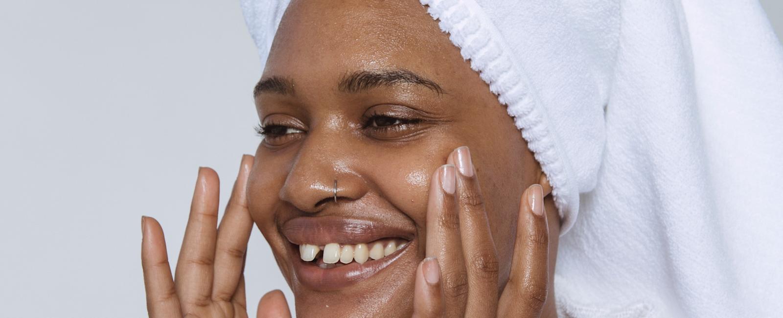 How To Get Rid Of Annoying Dark Spots: Hyperpigmentation