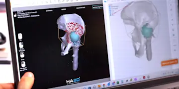 ultimaker-medics-3d-printing-models-scan-data
