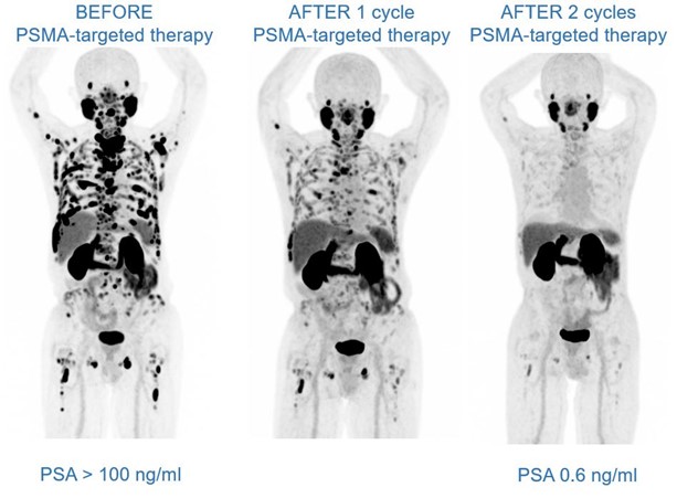 Before vs. After Therapy