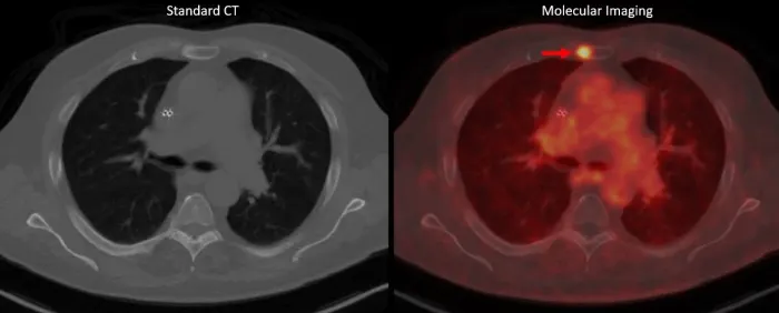 CT vs. Imaging