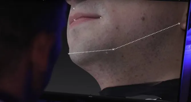顔の角度：頬、あごのライン、下顎の角