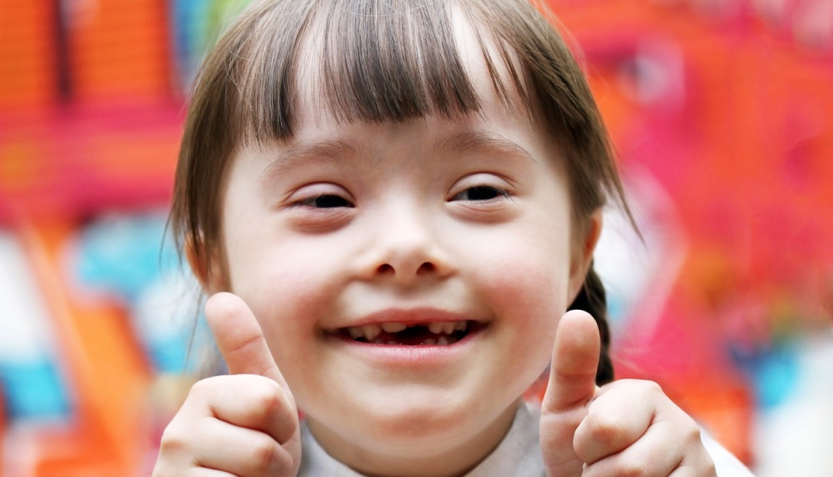 What's it like to have Down Syndrome?