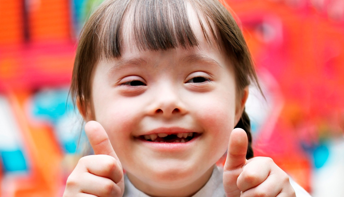 11 Facts About Down Syndrome