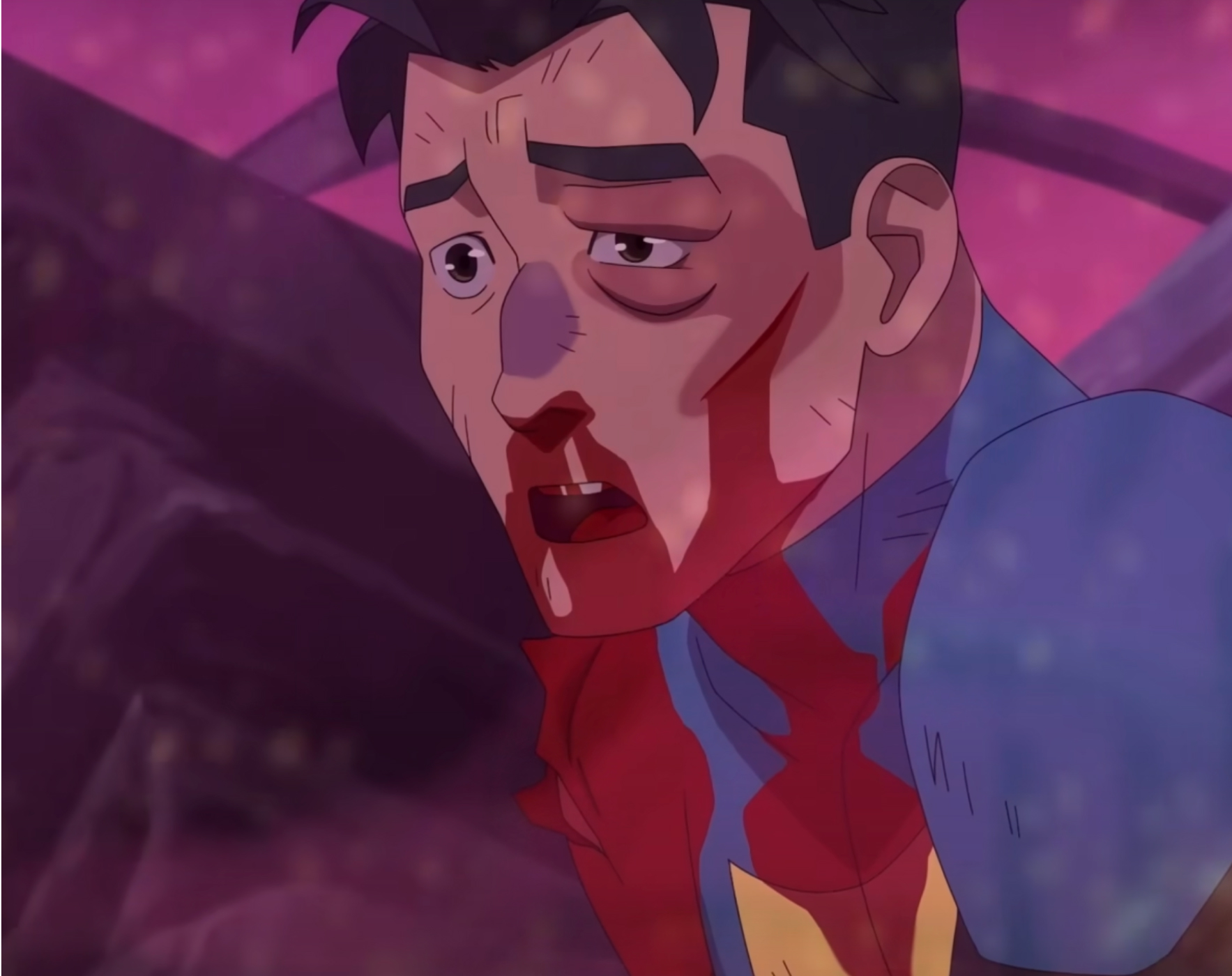 Invincible with a bloody nose after battle