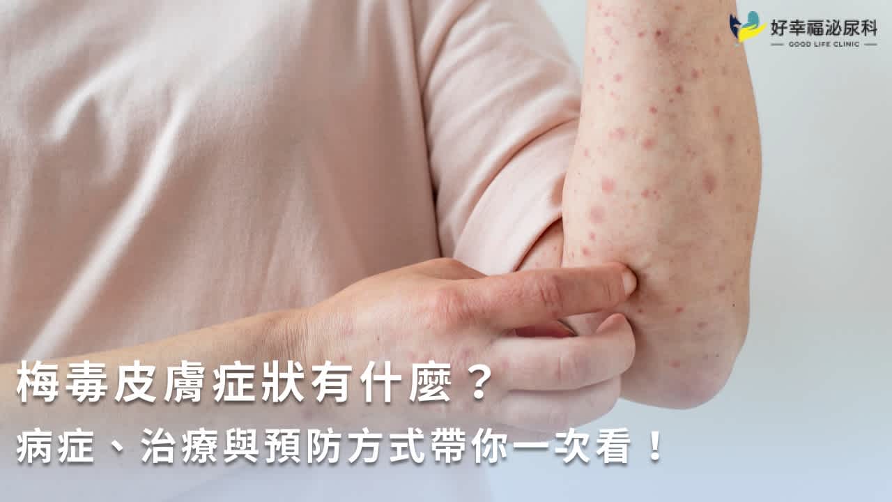 梅毒皮膚症狀有什麼?病症、治療與預防方式帶你一次看!