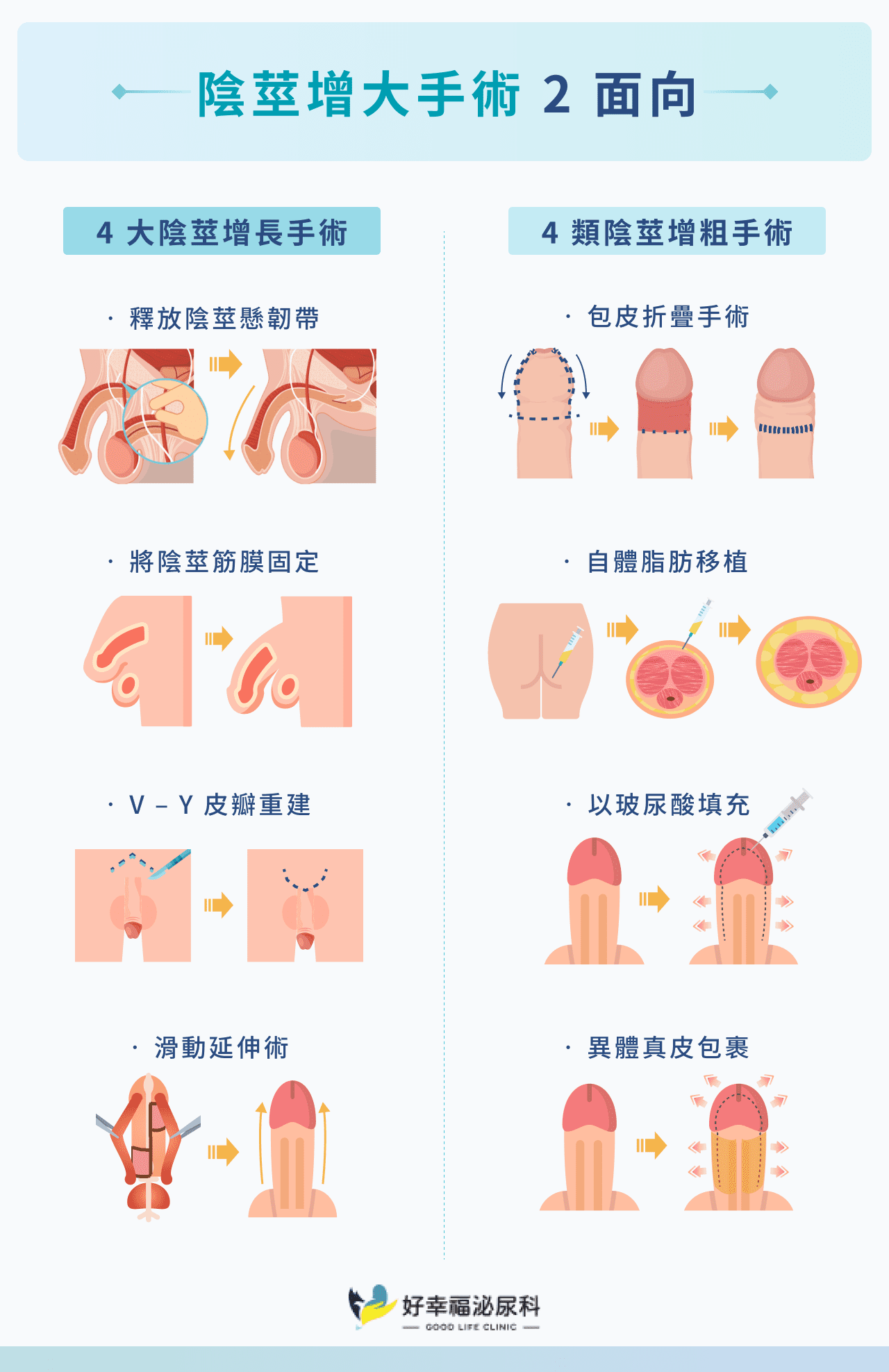 陰莖增大手術 2 面向