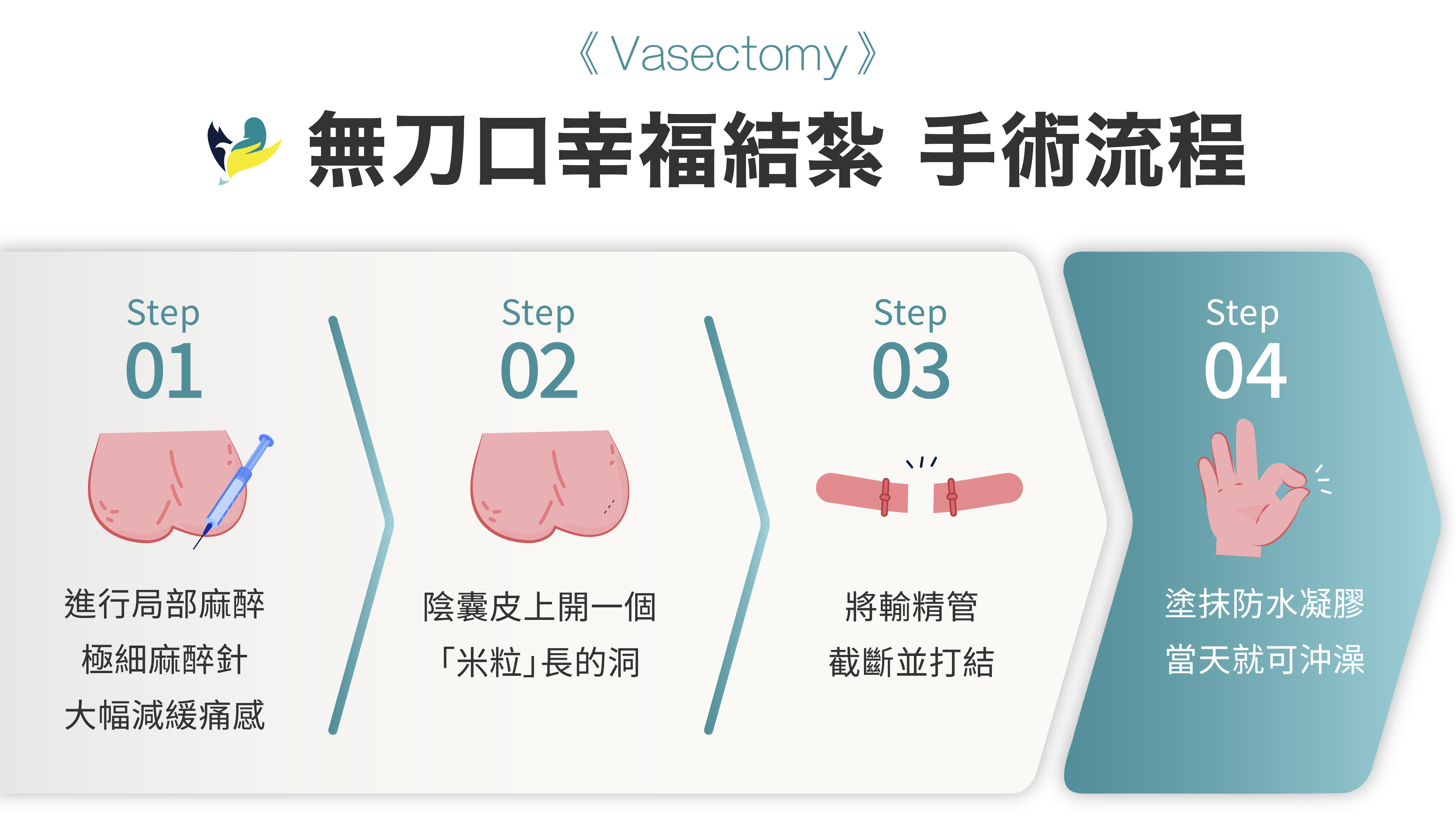 新版結紮：手術過程