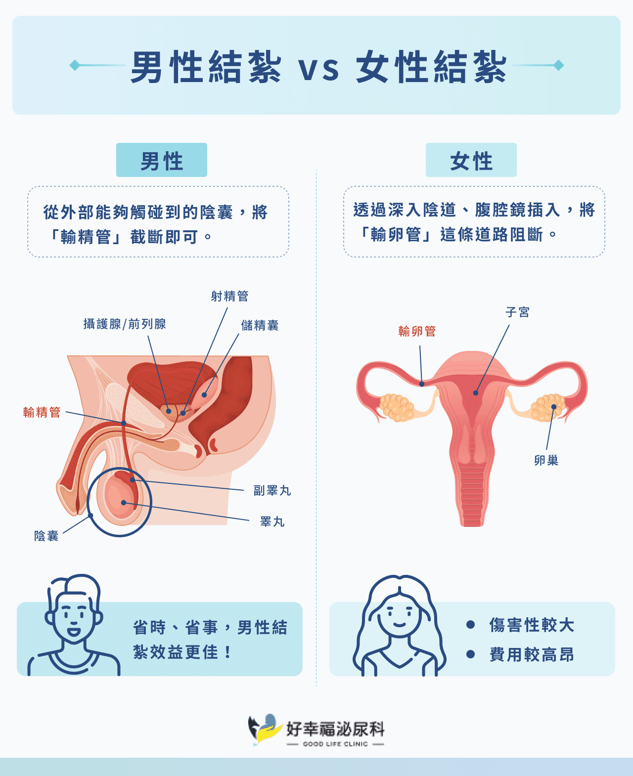 男性結紮 vs 女性結紮