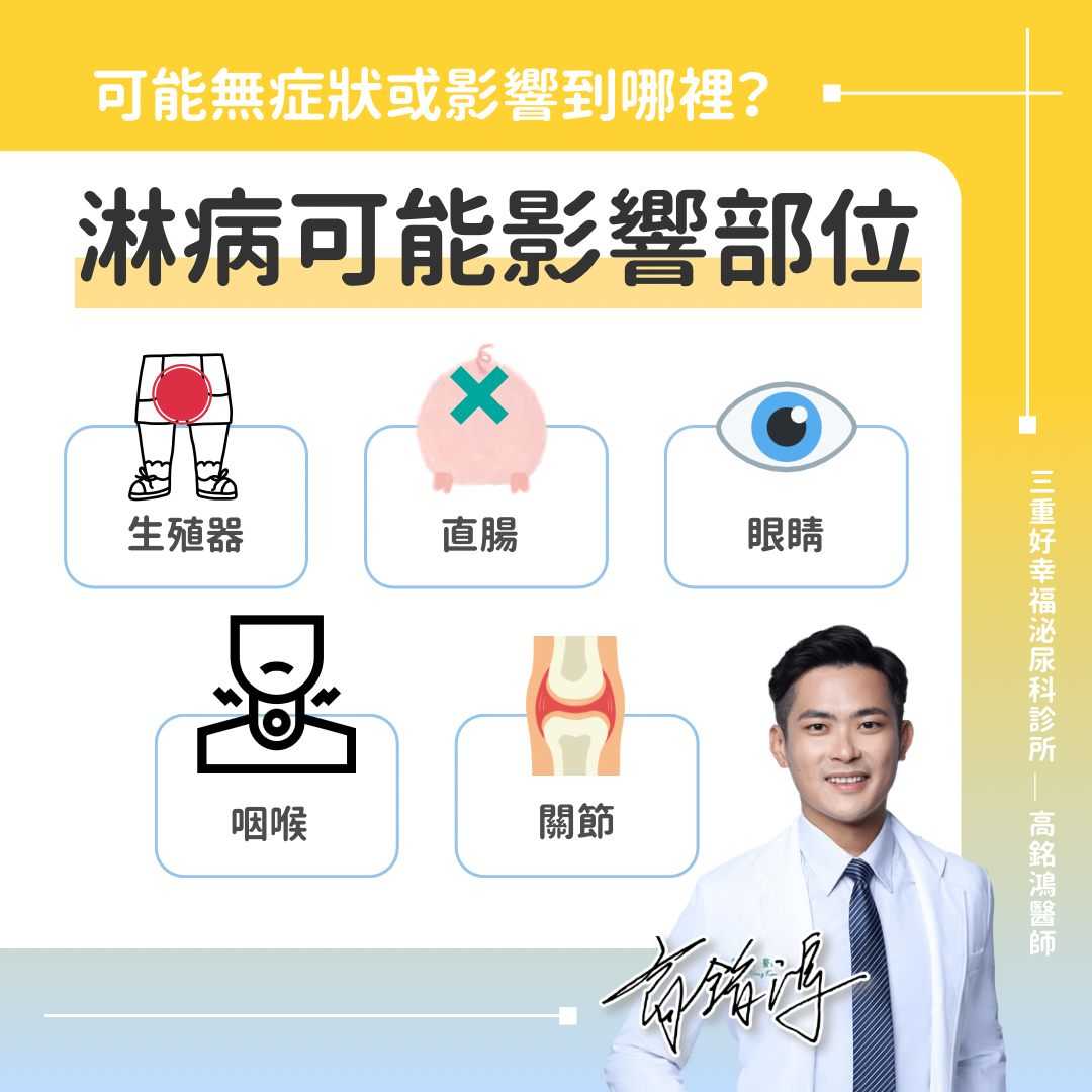 性健康知識:認識淋病