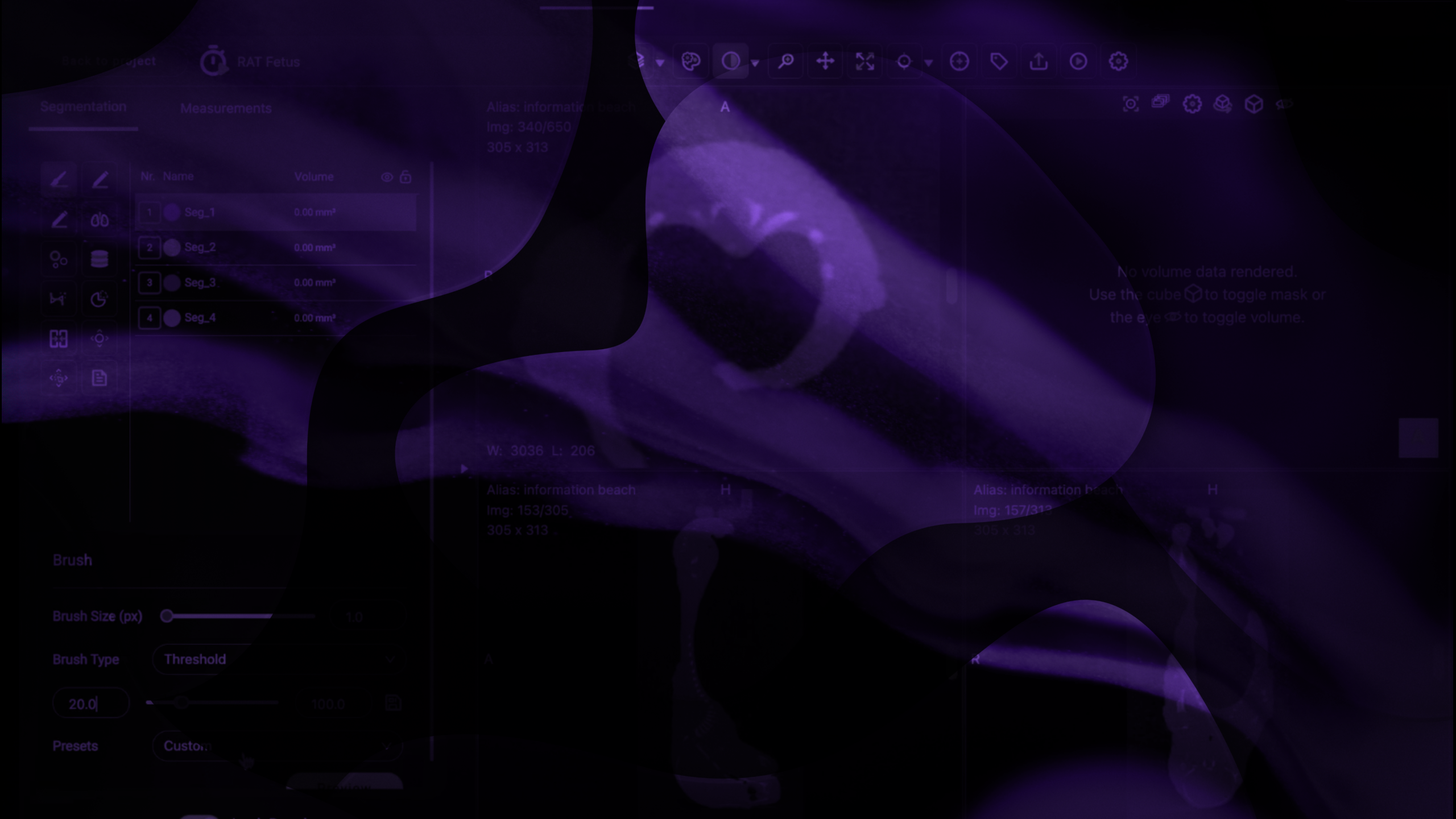 Inside Gesund AI: Annotation Module