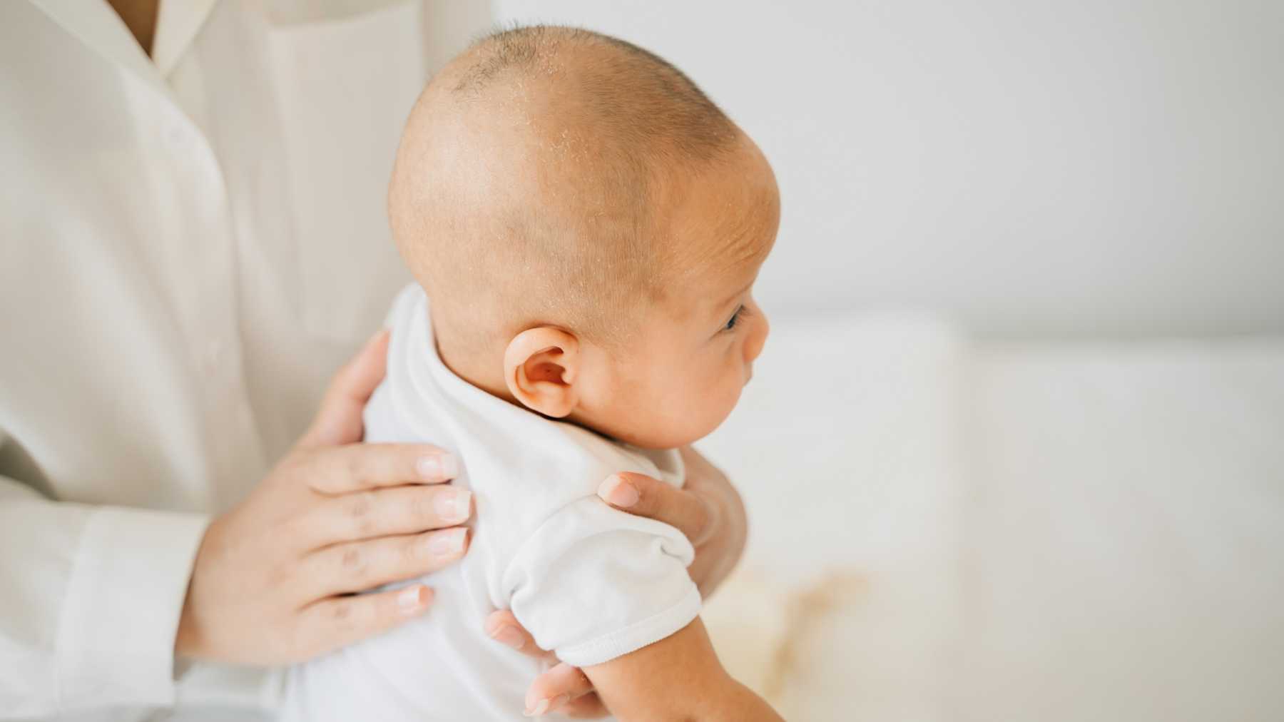 Natural Ways To Cure Hiccups Instantly