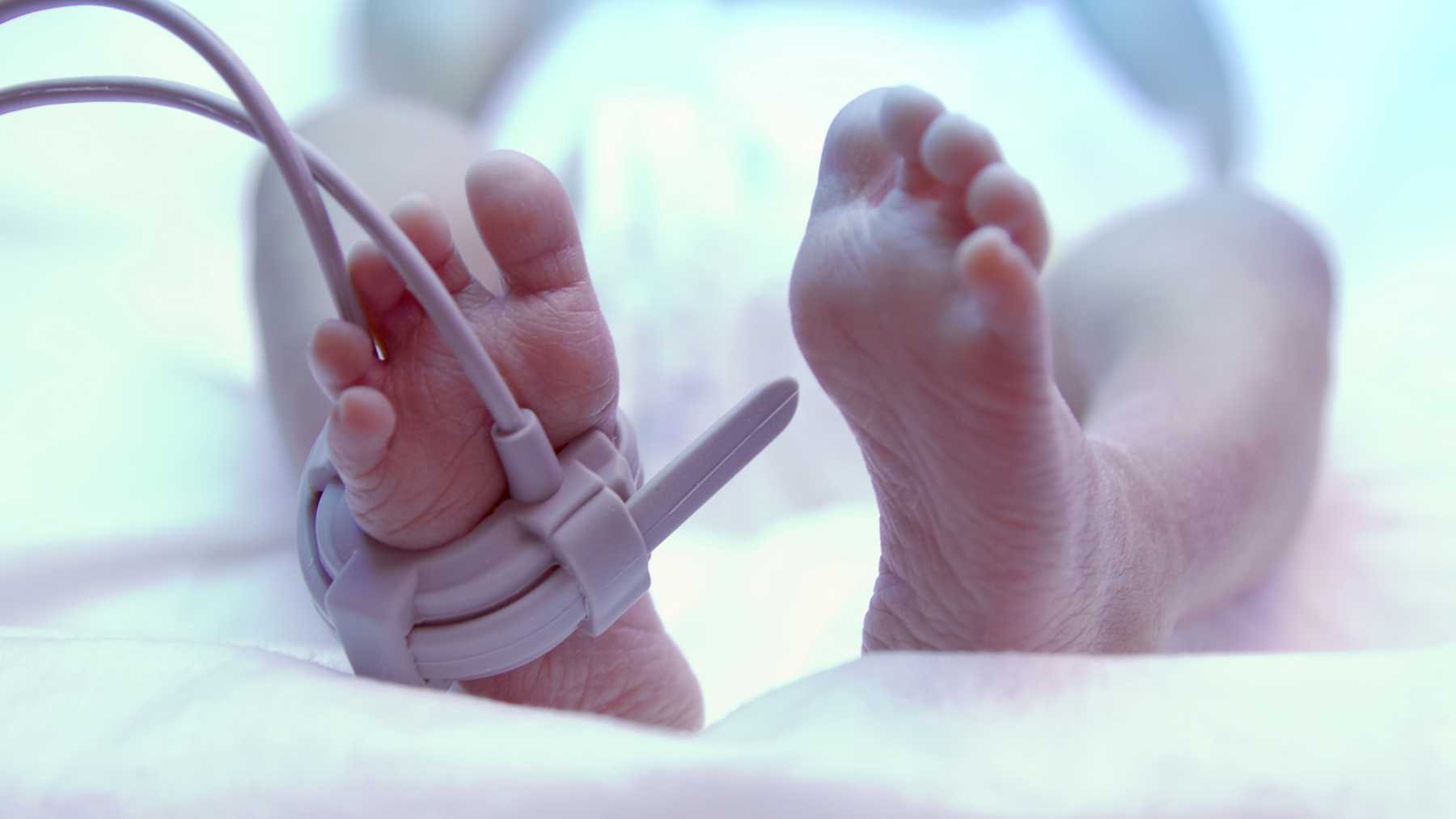 Declaran Muerto A Bebe Prematuro Por Error Y Comienza A Llorar En La Morgue Mamaslatinas Com Declaran Muerto A Bebe Prematuro Por Error Y Comienza A Llorar En La Morgue Mamaslatinas Com