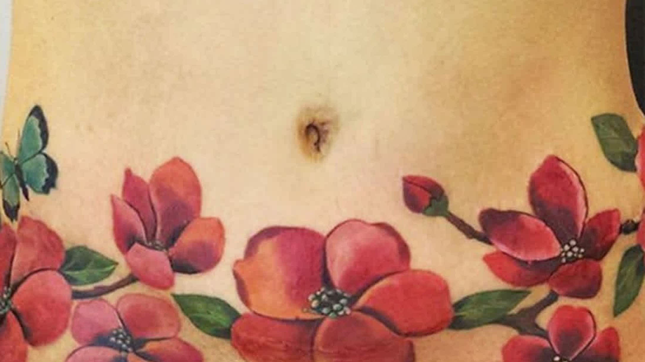 Tattoo uploaded by Scratch Tattoos  Tummy tucks and C section Scars  can make you feel ugly Getting tattooed may make you feel and look  beautiful again freehand tummytuck csection bythailandmike  Thailandmike 