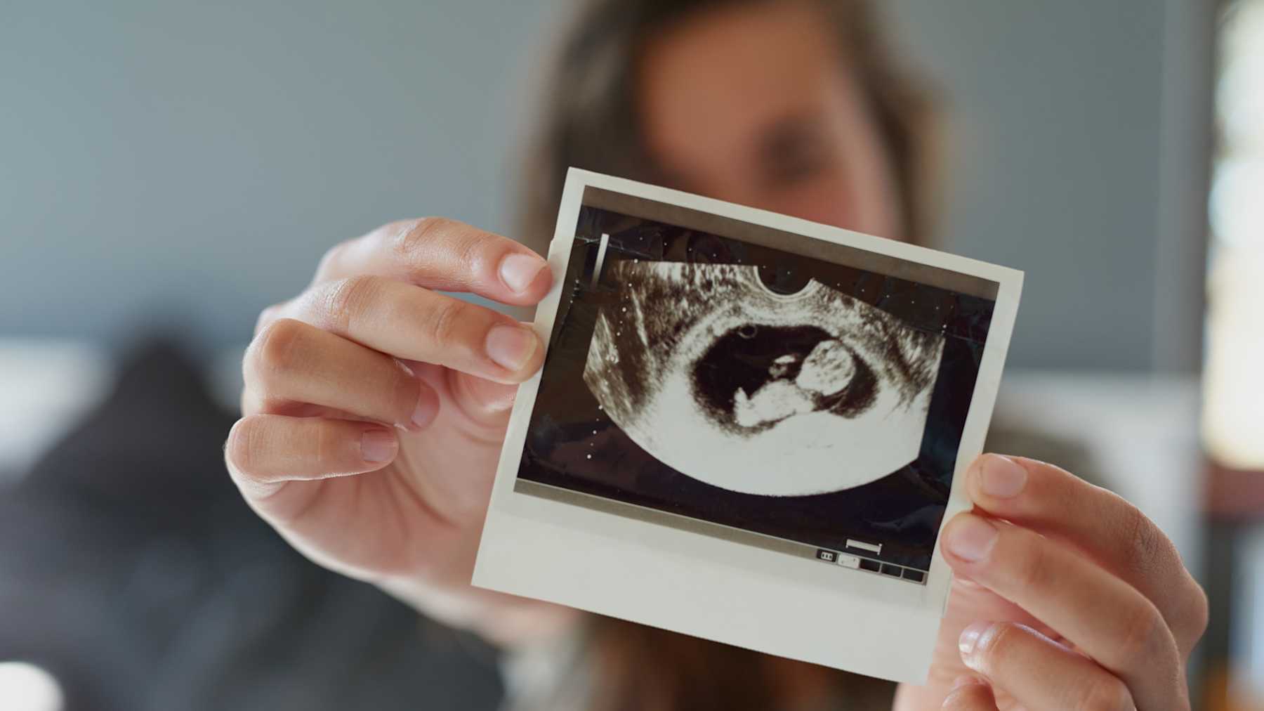 Asombrosos Ultrasonidos De Bebes Que Han Causado Revuelo Mamaslatinas Com Asombrosos Ultrasonidos De Bebes Que Han Causado Revuelo Mamaslatinas Com