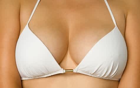 Can gap between breasts be reduced with bigger implants?? (photos)