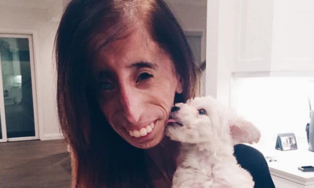 Lizzie Velasquez Called Ugliest Woman In The World