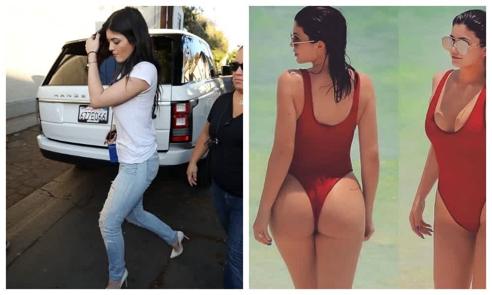 10 Signs Kylie Jenner probably had plastic surgery.