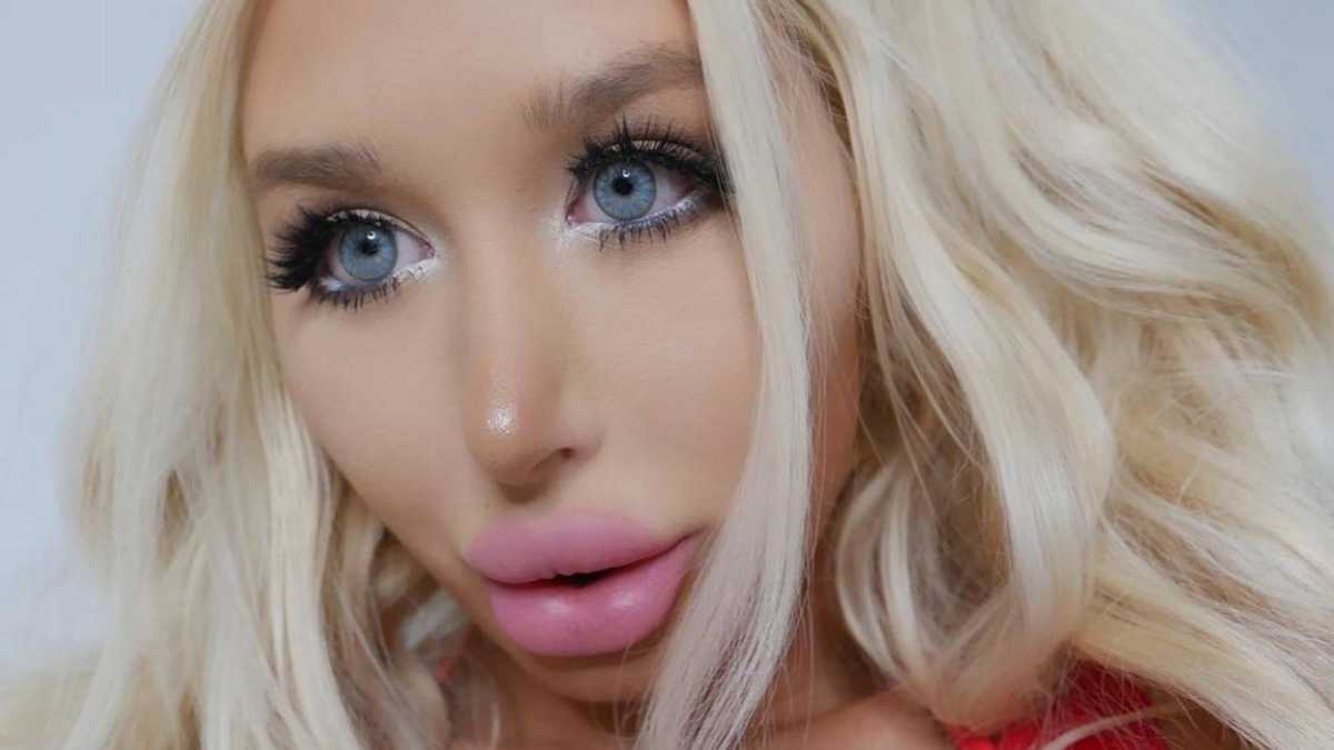 procedure barm Lab This woman almost died to look like Barbie | MamasLatinas.com