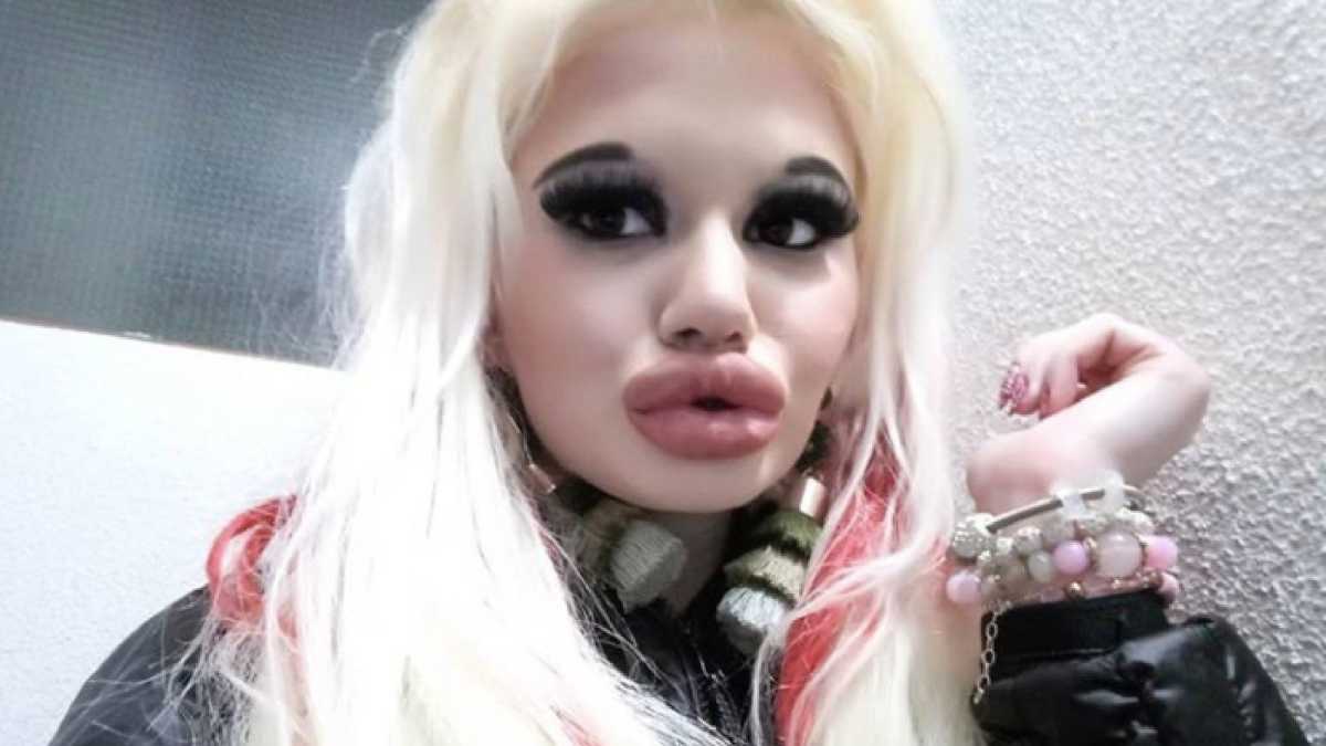 Real Life Barbie Who Had Over 15 Surgeries 20 Lip Fillers