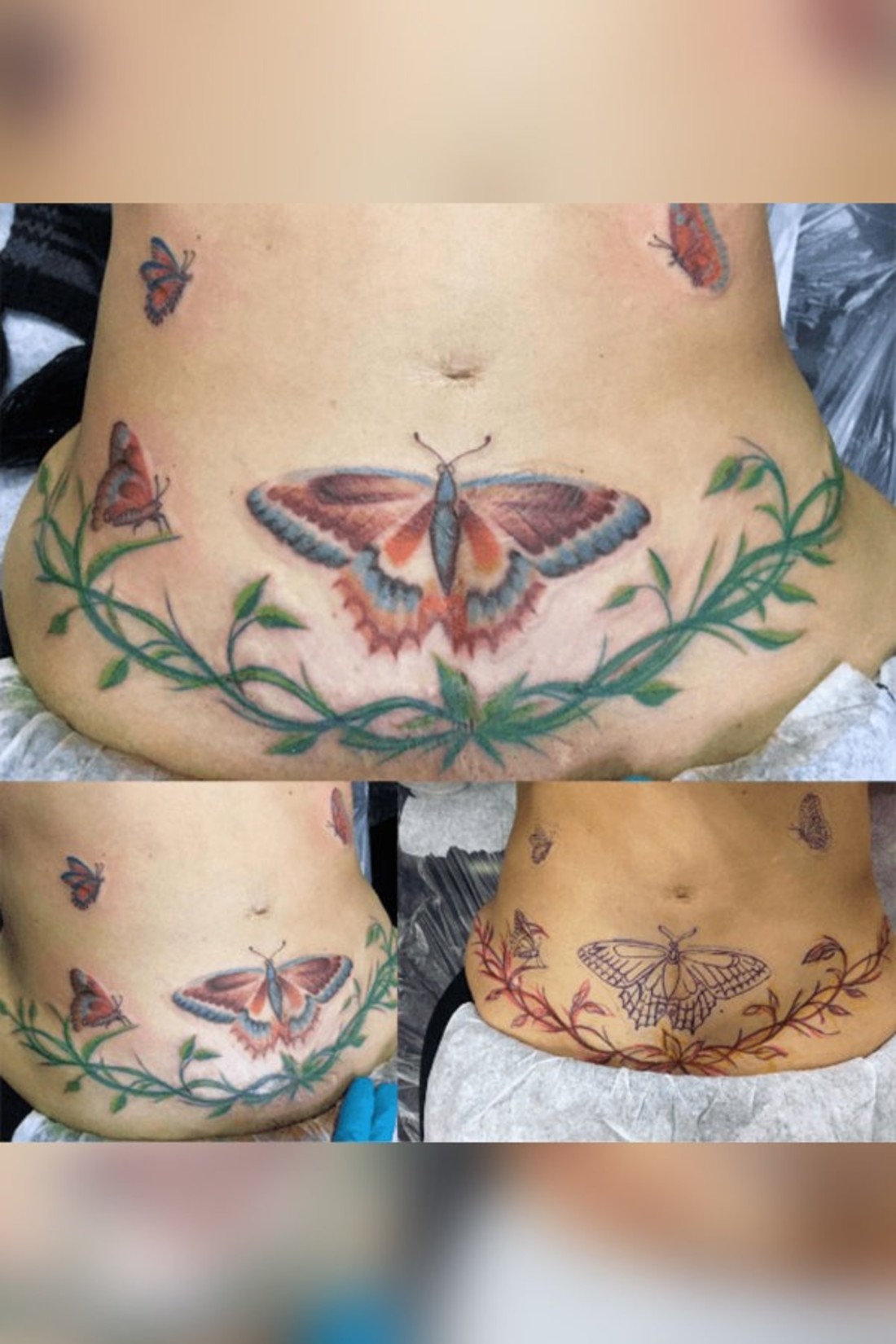 Share more than 75 c section tattoos best  thtantai2