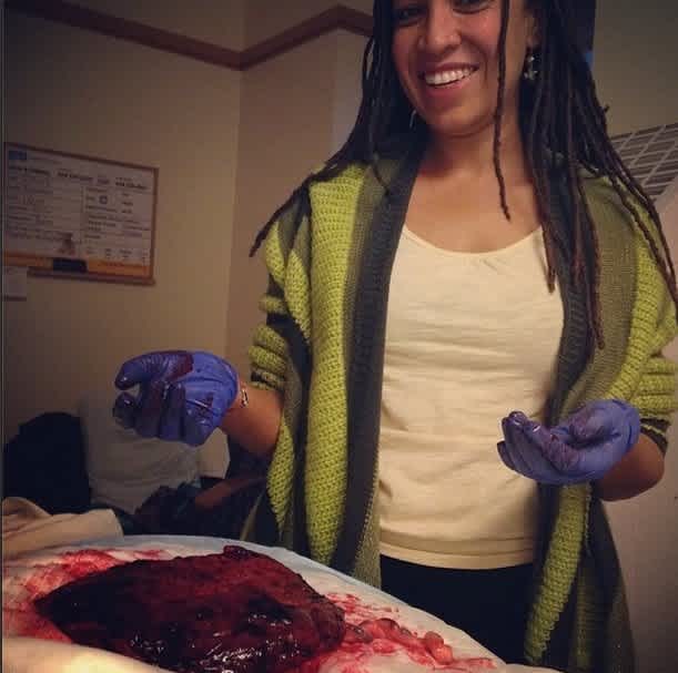 Beautiful Images Capture Lorio’s Wonderful Birth Moment At Home. 7 Placenta