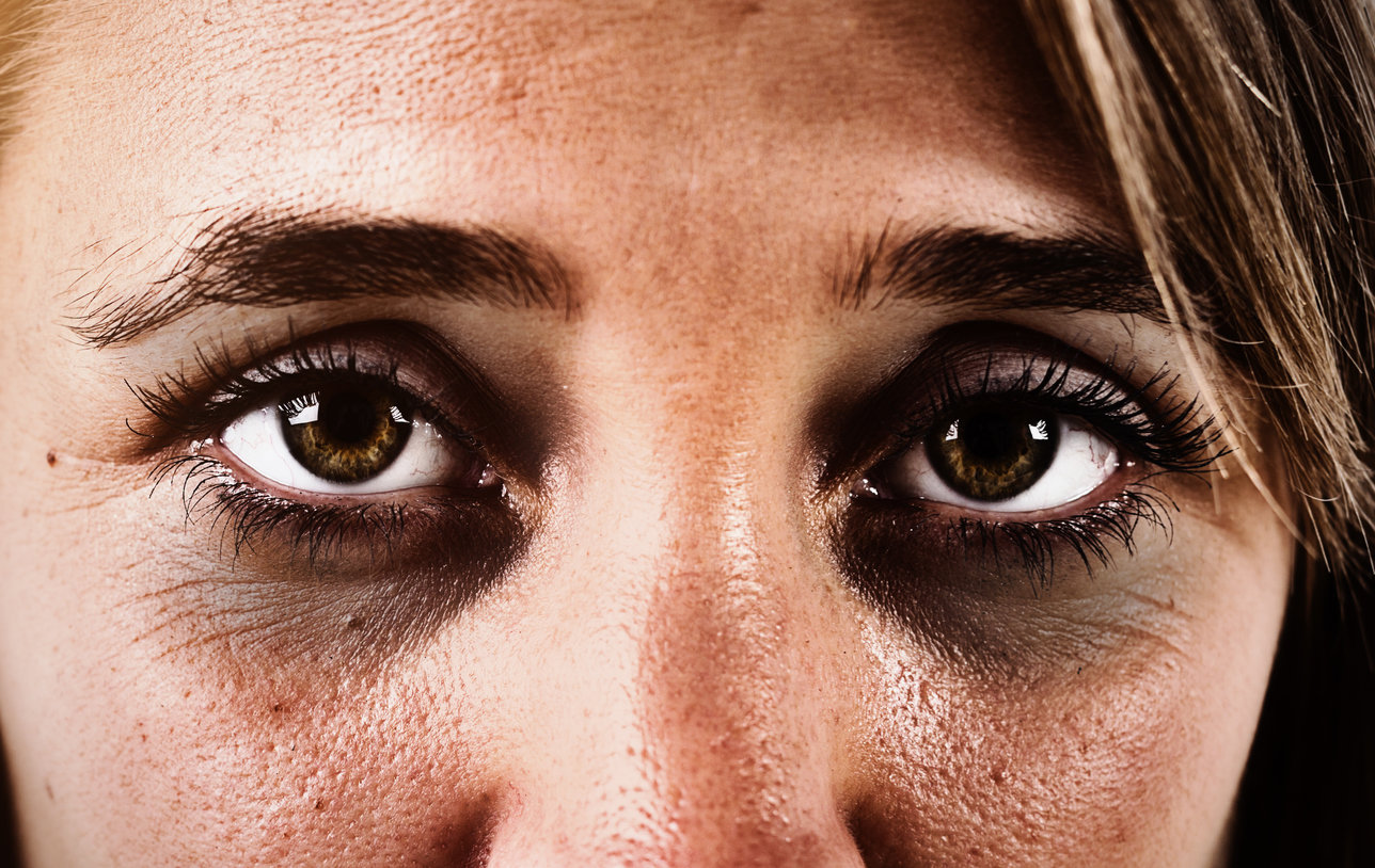 El café es enemigo de las ojeras.