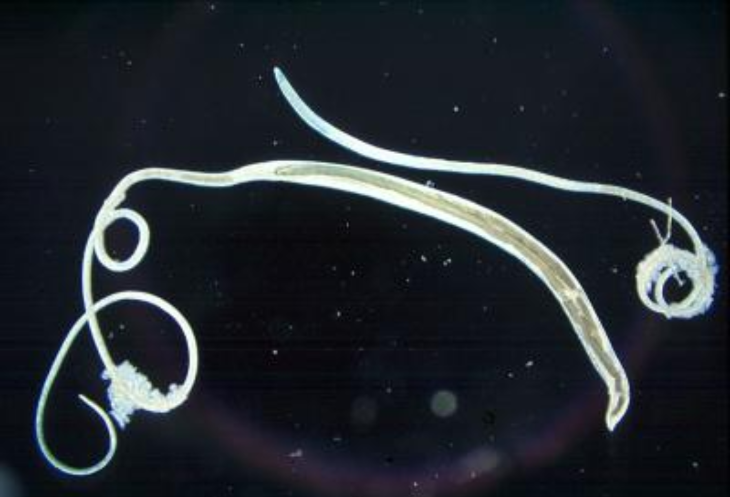 Image of a whipworm