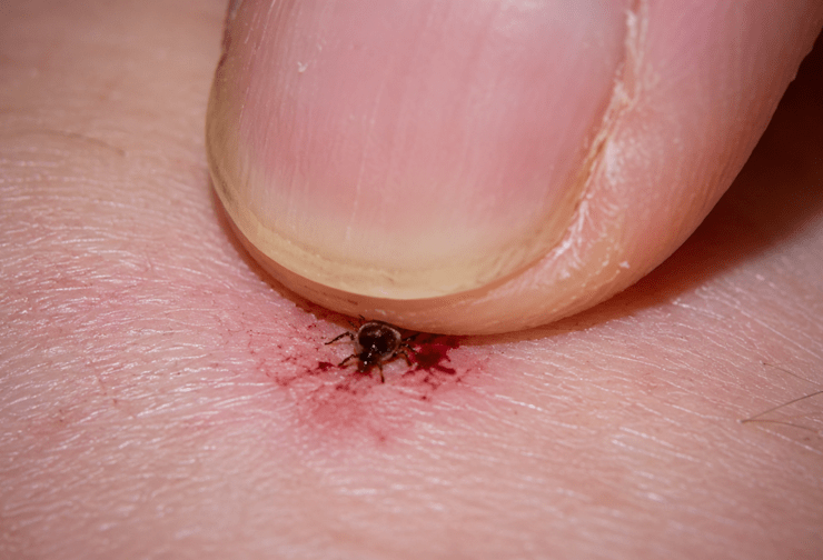 Best Tick & Lice Treatment and Killer Solutions | Cats & Dogs