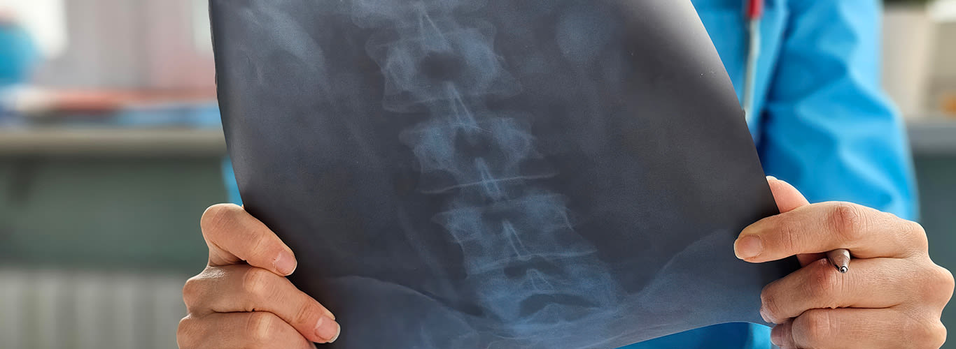 Popular courses in the UK - BANNER - Radiology - Person holding an X-ray