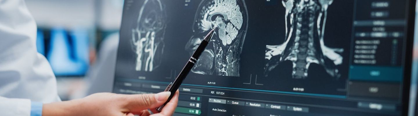 An x-ray of a human brain