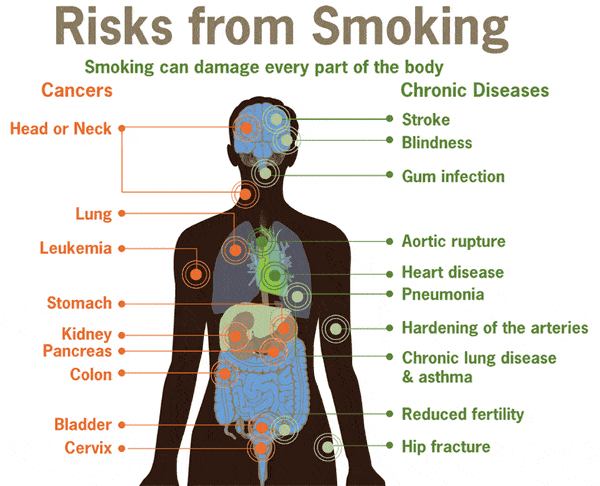 Smoking Risks infographic